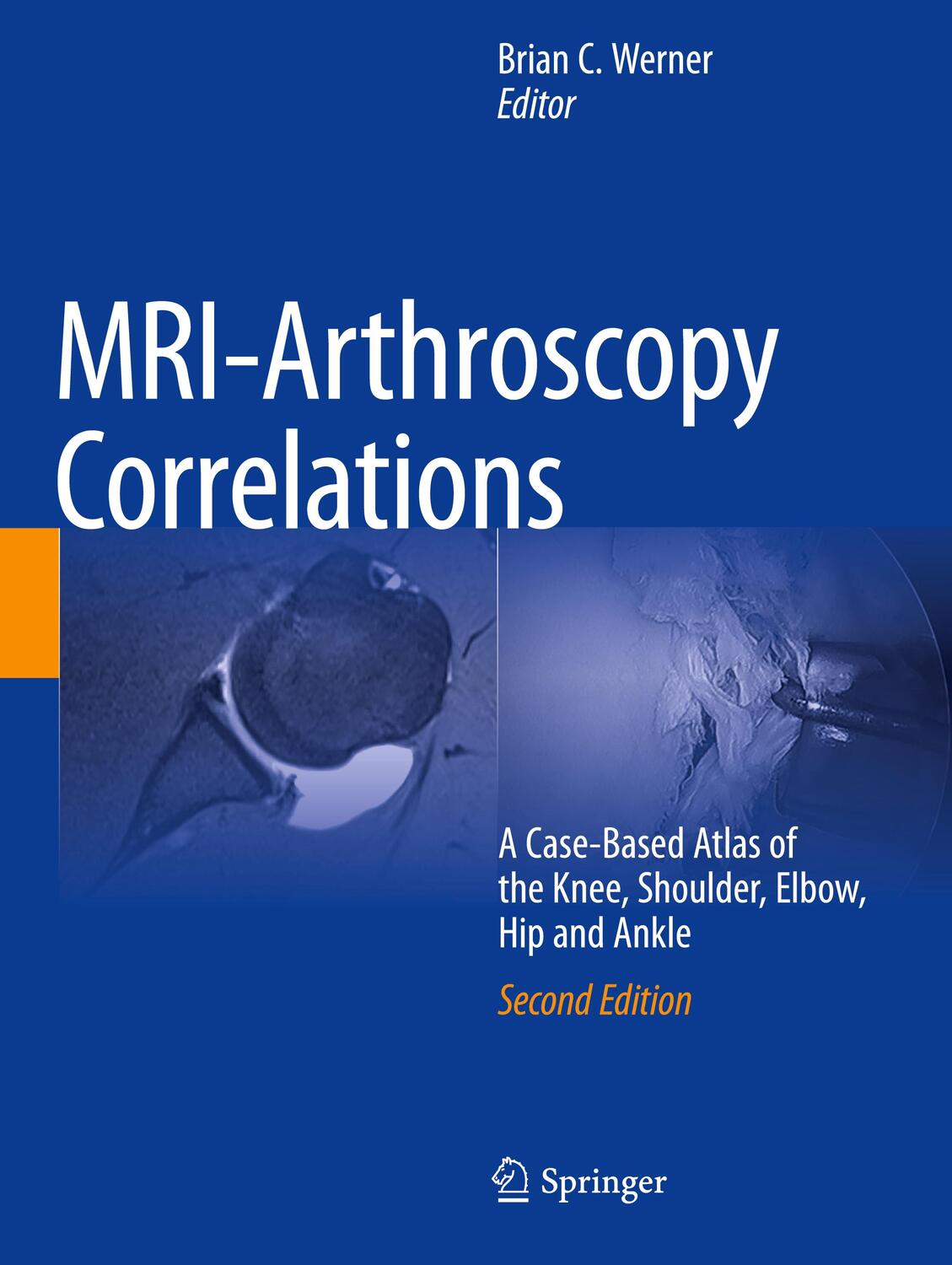 Cover: 9783030947910 | MRI-Arthroscopy Correlations | Brian C. Werner | Taschenbuch | 2023