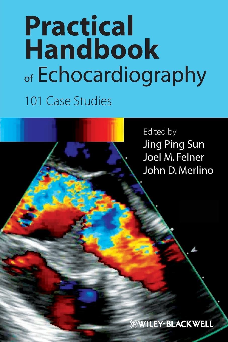 Cover: 9781405195560 | Handbook Echocardiography | Sun | Taschenbuch | Paperback | 366 S.
