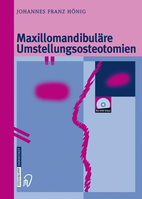 Cover: 9783642632846 | Maxillomandibuläre Umstellungsosteotomien | Johannes-Franz Hönig | x