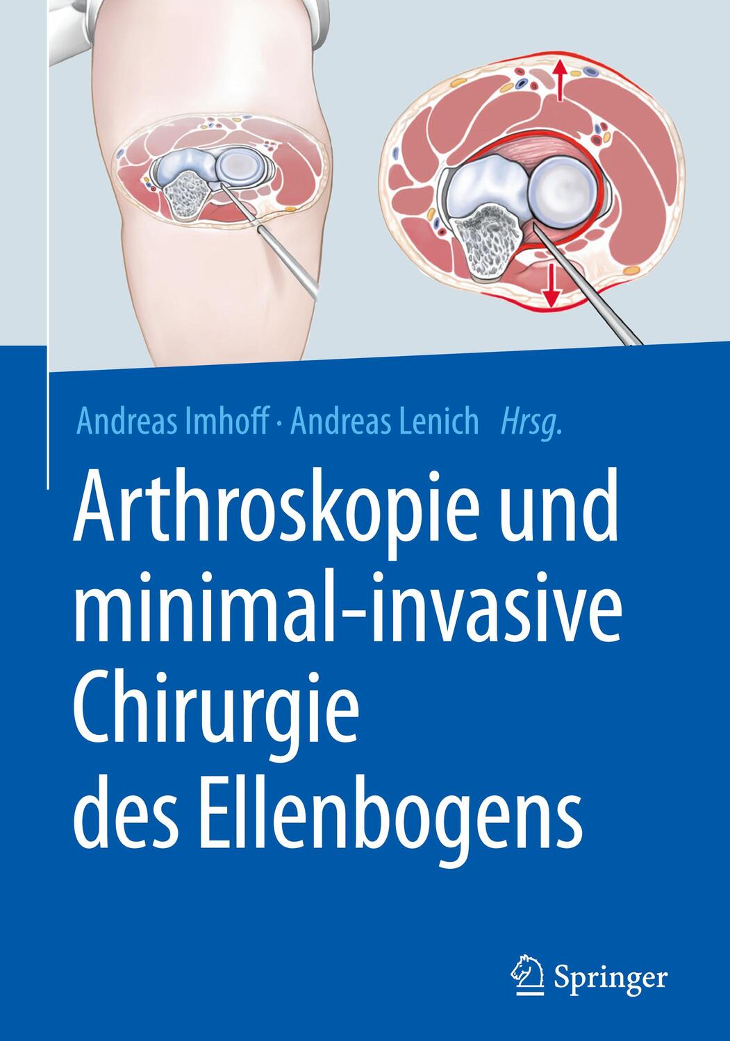 Cover: 9783662566787 | Arthroskopie und minimal-invasive Chirurgie des Ellenbogens | Buch