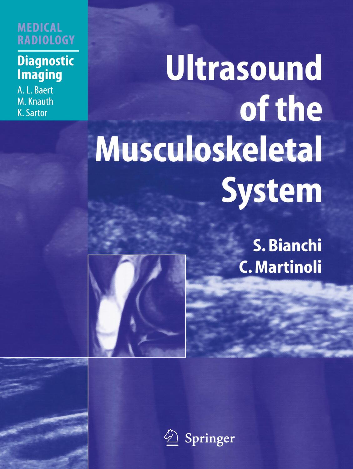 Cover: 9783540422679 | Ultrasound of the Musculoskeletal System | Carlo Martinoli (u. a.)