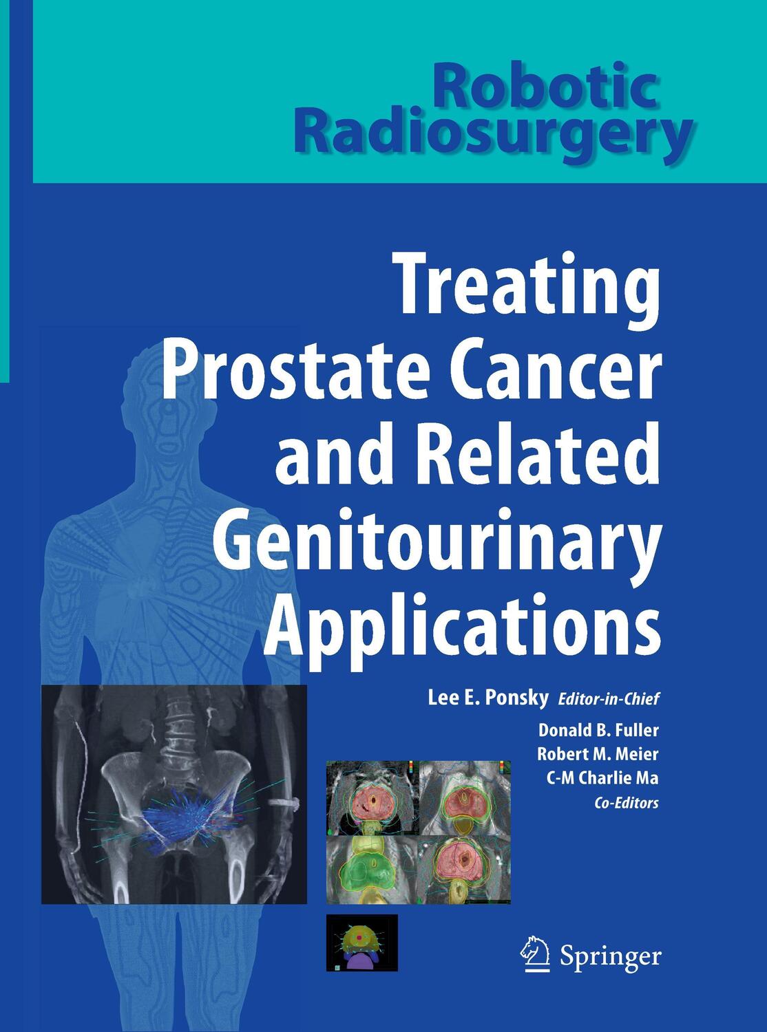 Cover: 9783662519608 | Robotic Radiosurgery Treating Prostate Cancer and Related...