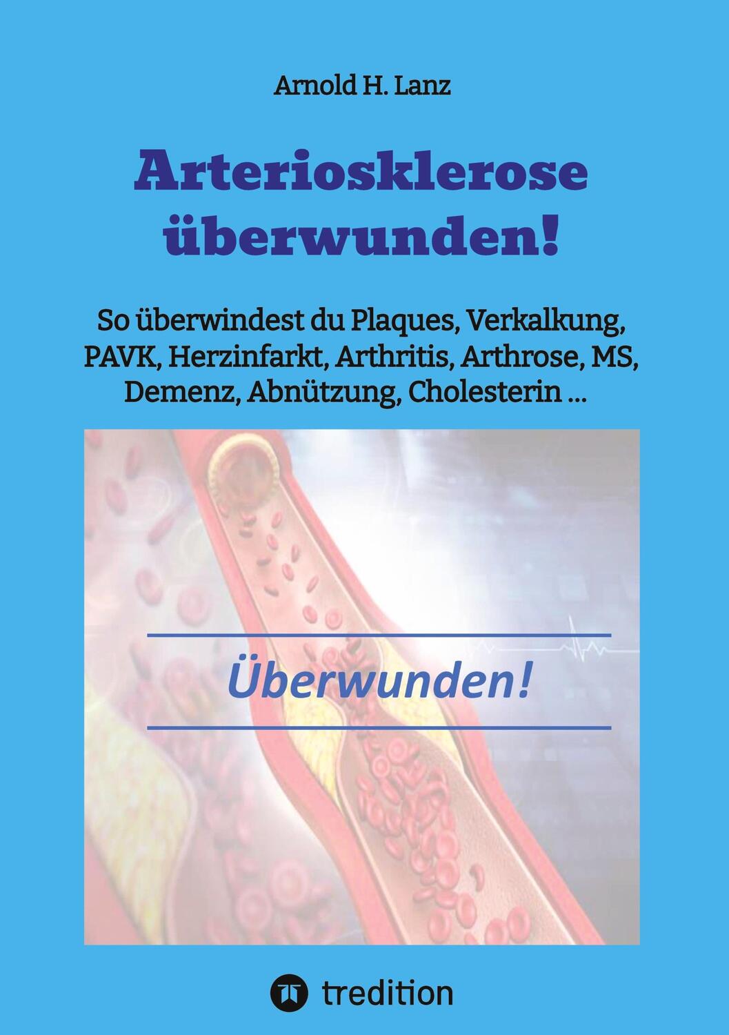 Cover: 9783384006479 | Arteriosklerose überwunden! | Arnold H. Lanz | Taschenbuch | Paperback