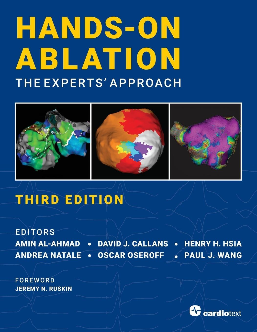 Cover: 9781942909408 | Hands-On Ablation, The Experts' Approach, Third Edition | Hsia | Buch
