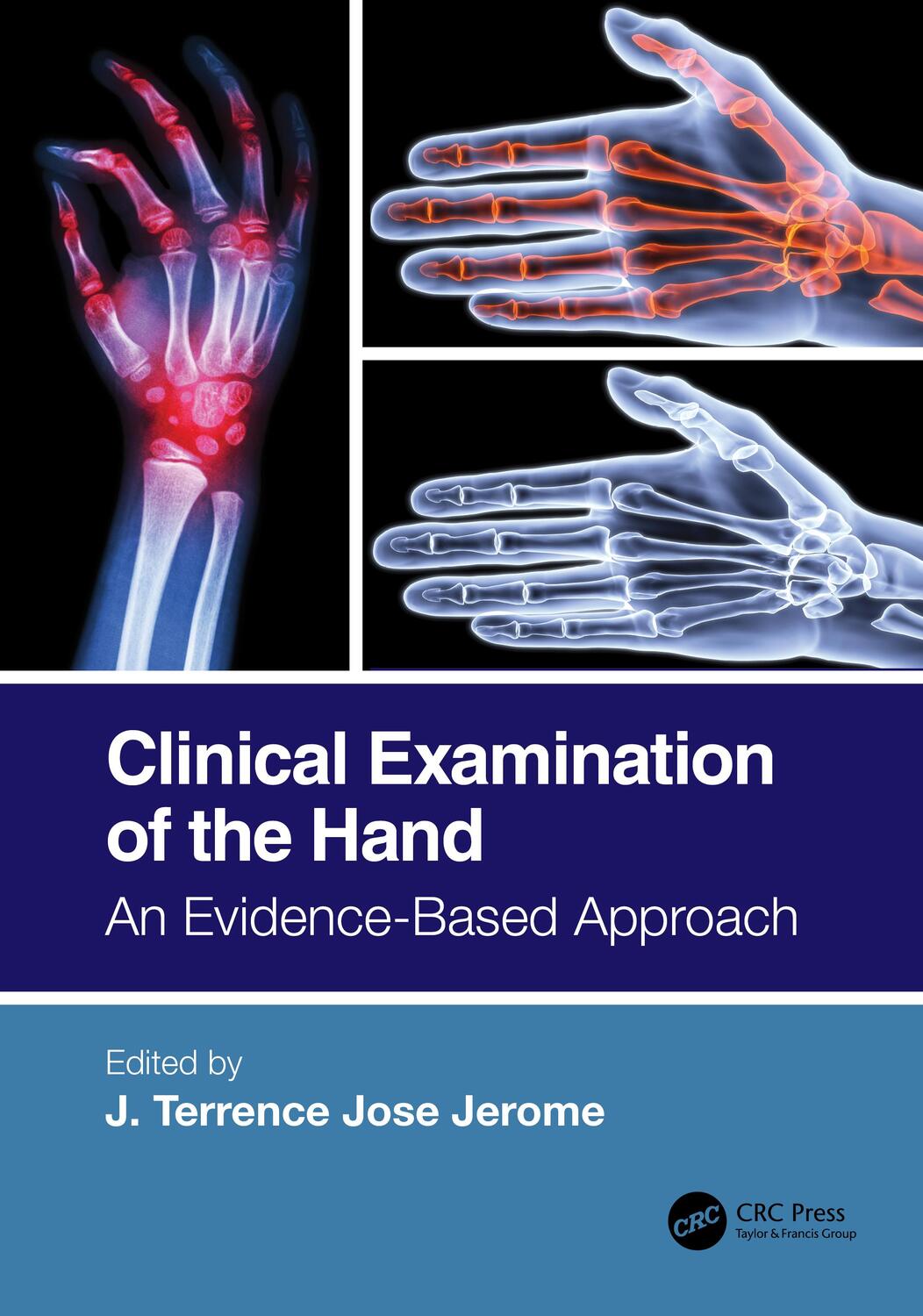 Cover: 9780367647162 | Clinical Examination of the Hand | An Evidence-Based Approach | Jerome