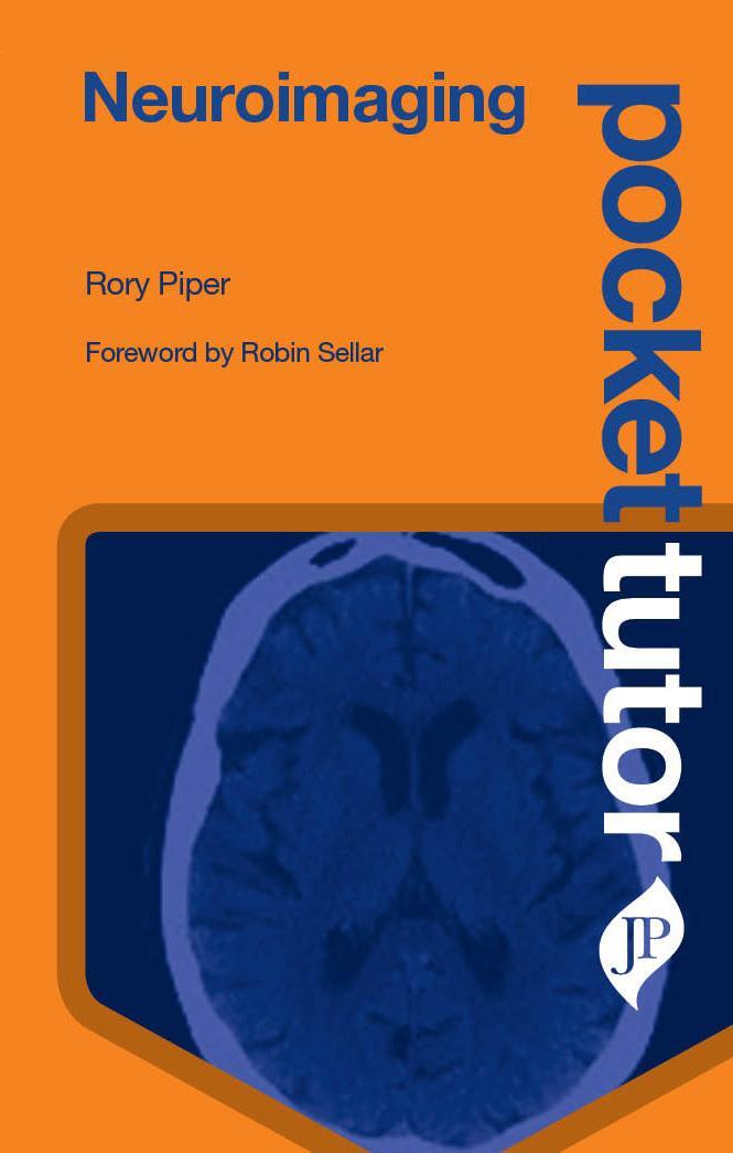 Cover: 9781909836570 | Pocket Tutor Neuroimaging | Rory Piper | Taschenbuch | Englisch | 2018