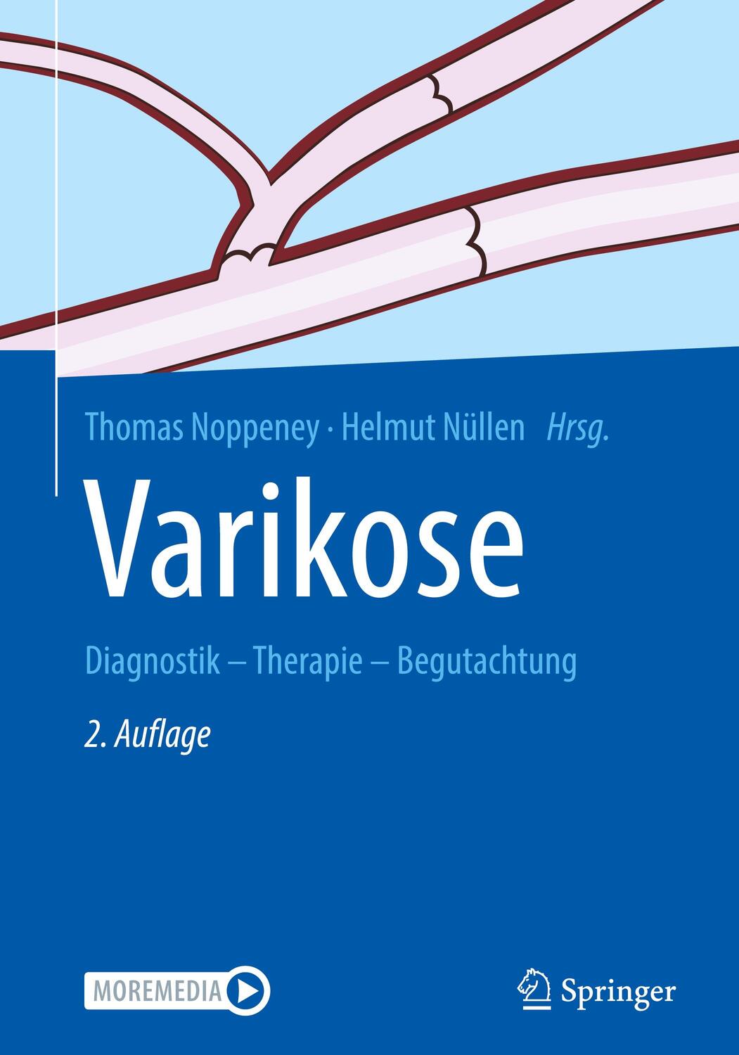 Cover: 9783662591161 | Varikose | Diagnostik - Therapie - Begutachtung | Noppeney (u. a.)