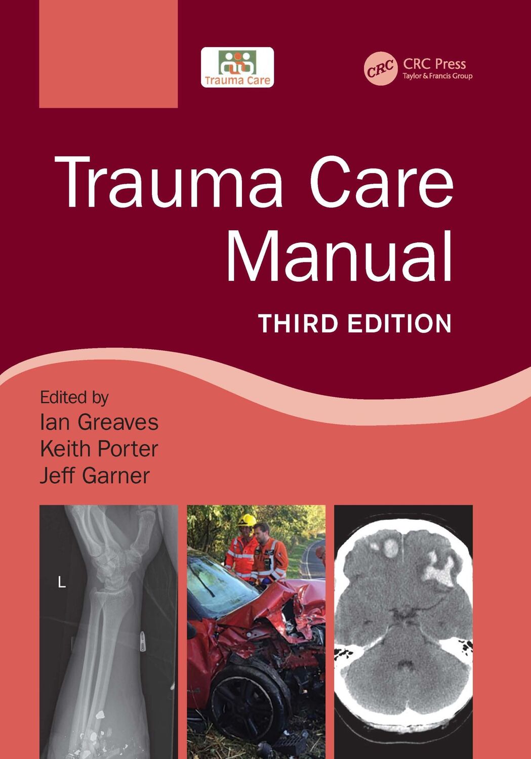 Cover: 9781498788847 | Trauma Care Manual | Ian Greaves (u. a.) | Taschenbuch | Englisch