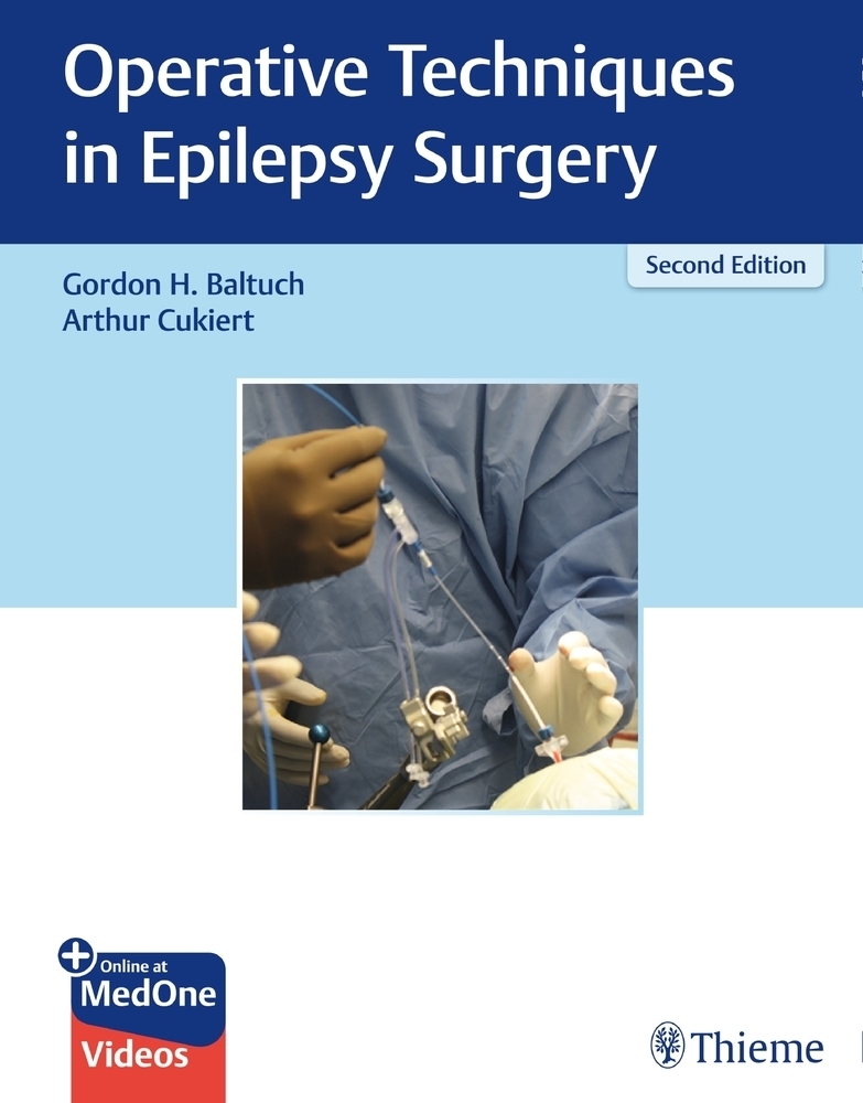 Cover: 9781626238183 | Operative Techniques in Epilepsy Surgery | Gordon H. Baltuch (u. a.)