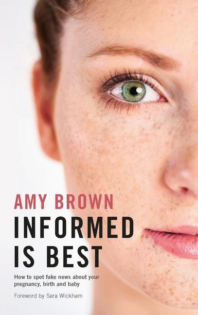 Cover: 9781780664903 | Informed is Best | Amy Brown | Taschenbuch | Kartoniert / Broschiert