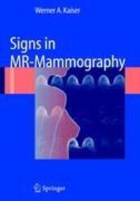 Cover: 9783642092336 | Signs in MR-Mammography | Werner A. Kaiser | Taschenbuch | Paperback