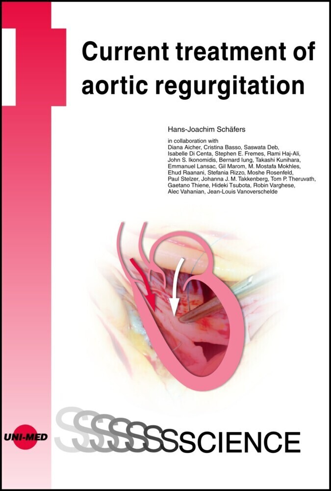 Cover: 9783837414066 | Current treatment of aortic regurgitation | Hans-Joachim Schäfers