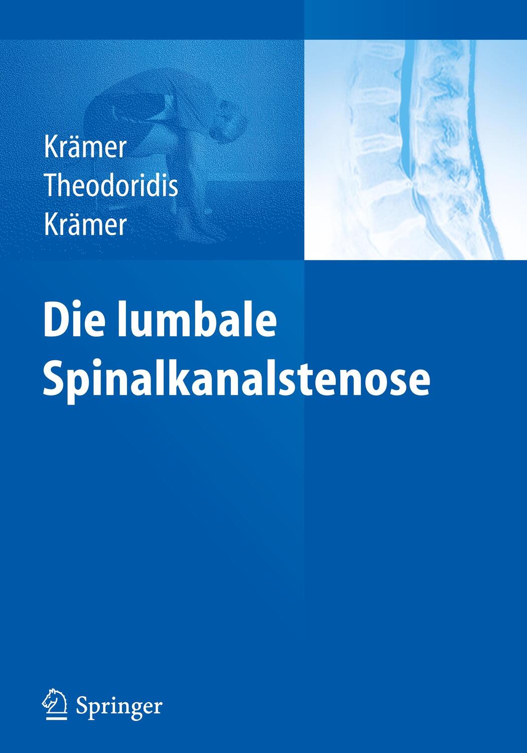 Cover: 9783642138423 | Die lumbale Spinalkanalstenose | Robert Krämer (u. a.) | Buch | 2011