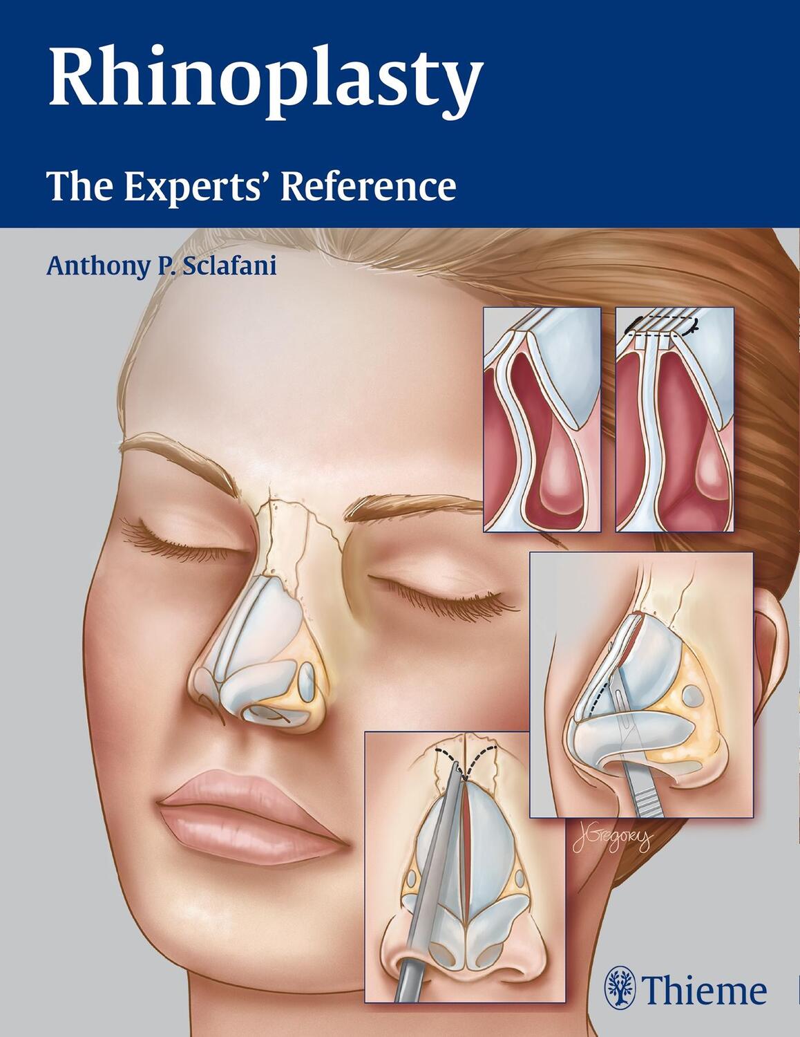 Cover: 9781604068672 | Rhinoplasty: The Experts' Reference | Anthony P. Sclafani | Buch