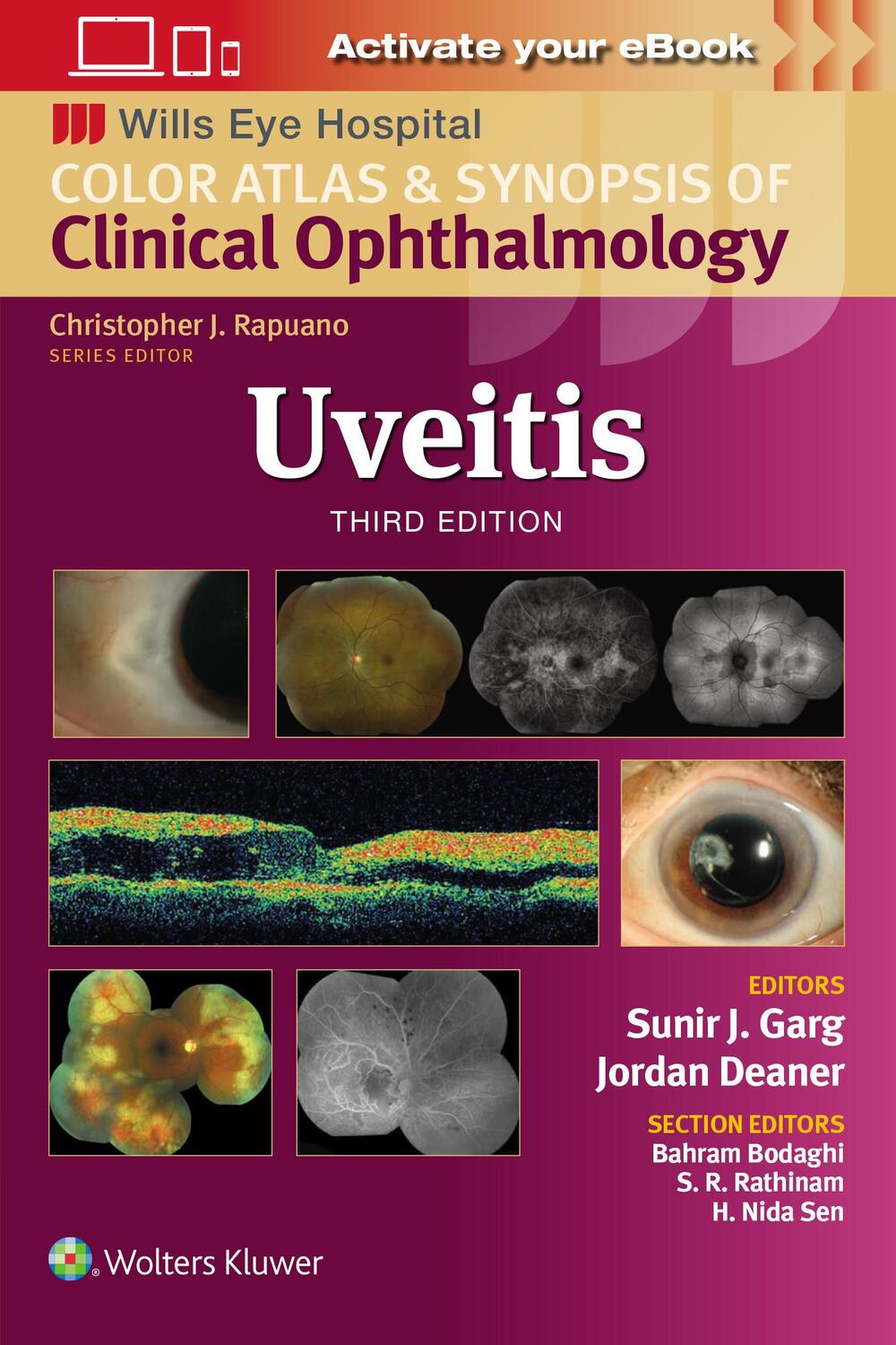 Cover: 9781975215194 | Uveitis | Sunir J. Garg | Taschenbuch | Englisch | 2024