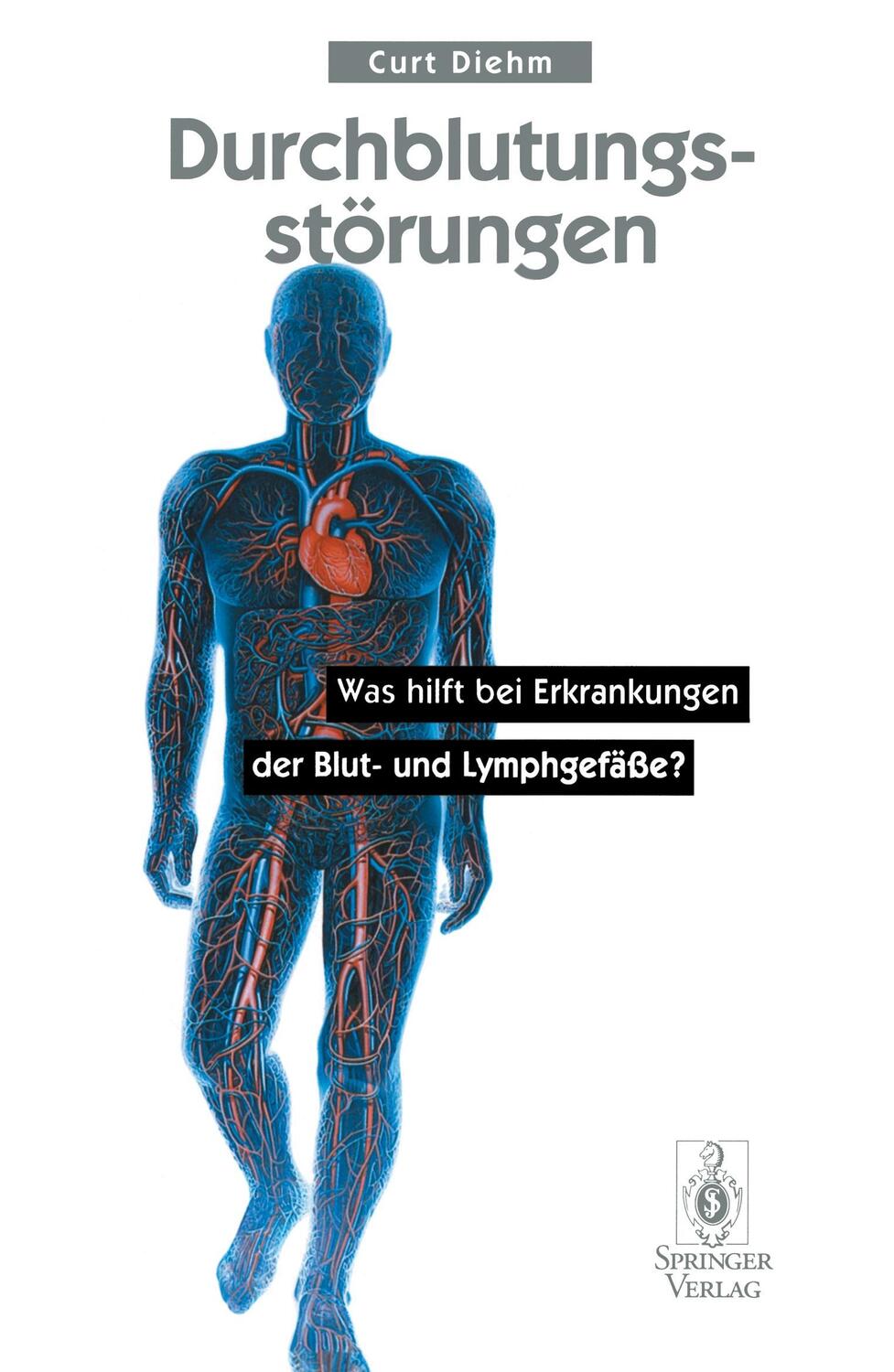 Cover: 9783540605270 | Durchblutungsstörungen | Curt Diehm | Taschenbuch | Springer