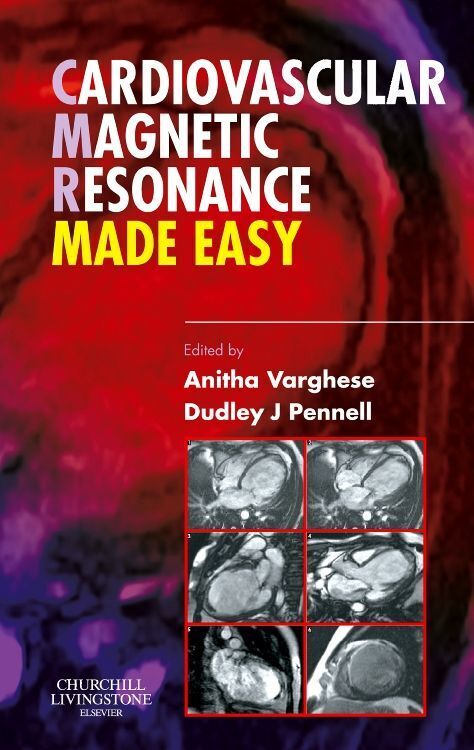 Cover: 9780443103018 | Cardiovascular Magnetic Resonance Made Easy | Anitha Varghese (u. a.)