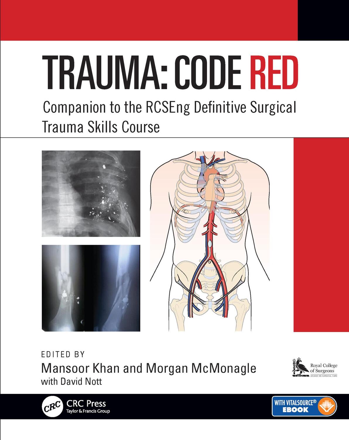 Cover: 9781138477018 | Trauma: Code Red | Mansoor Khan (u. a.) | Taschenbuch | Englisch
