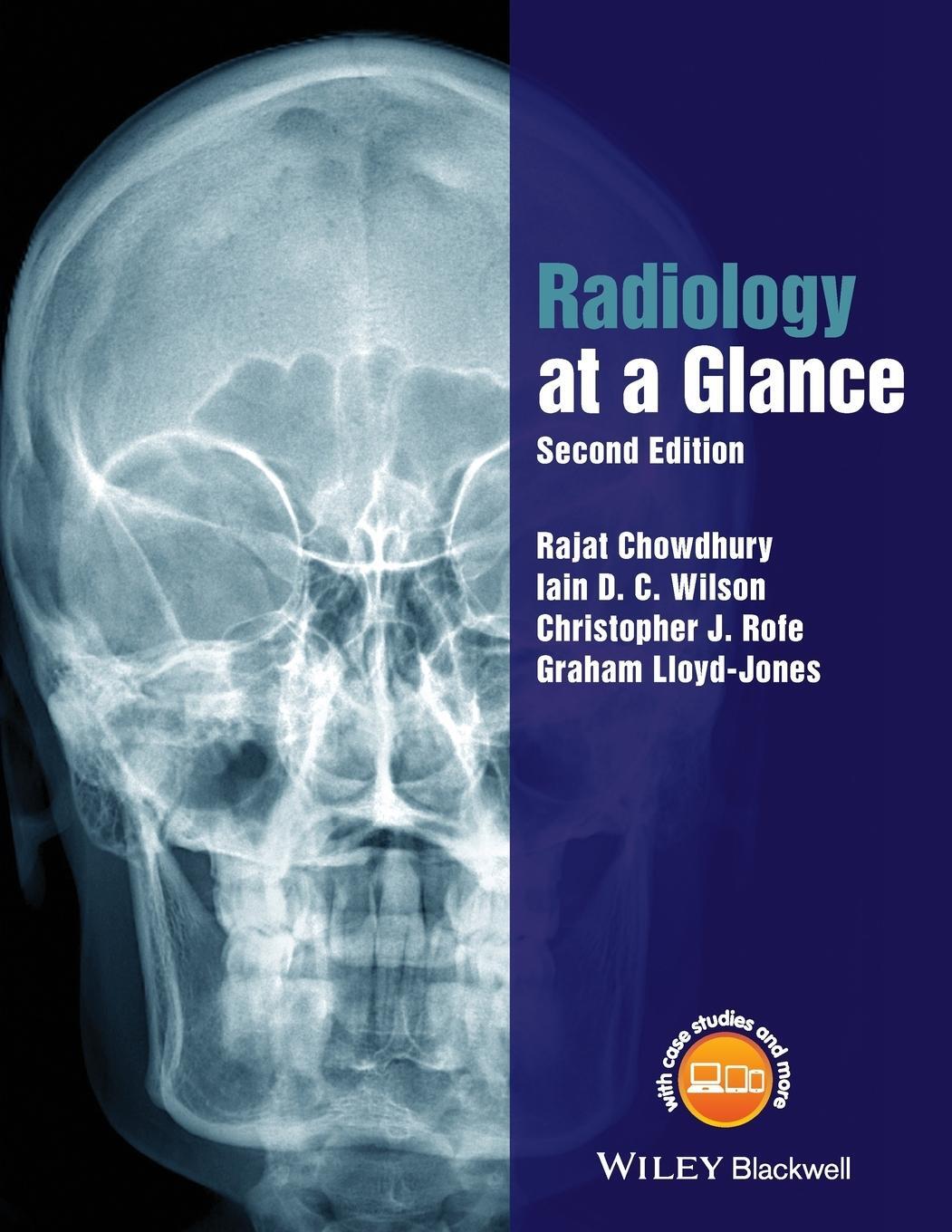 Cover: 9781118914779 | Radiology at a Glance | Christopher Rofe (u. a.) | Taschenbuch | 2017
