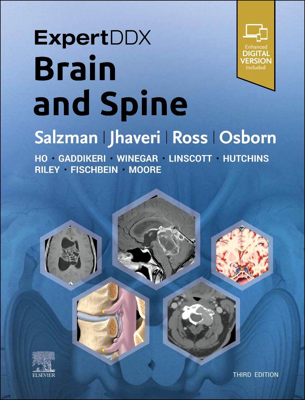Cover: 9780443106941 | ExpertDDx: Brain and Spine | Karen L. Salzman (u. a.) | Buch | 2023