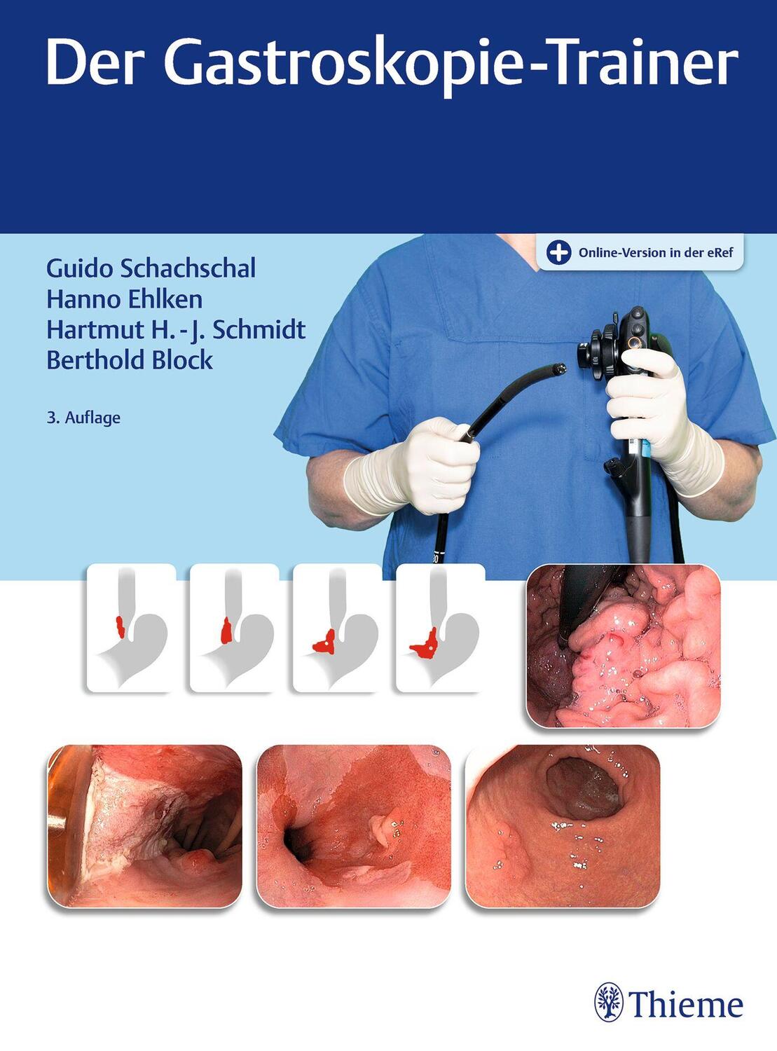 Cover: 9783131354334 | Der Gastroskopie-Trainer | Guido Schachschal (u. a.) | Bundle | 1 Buch