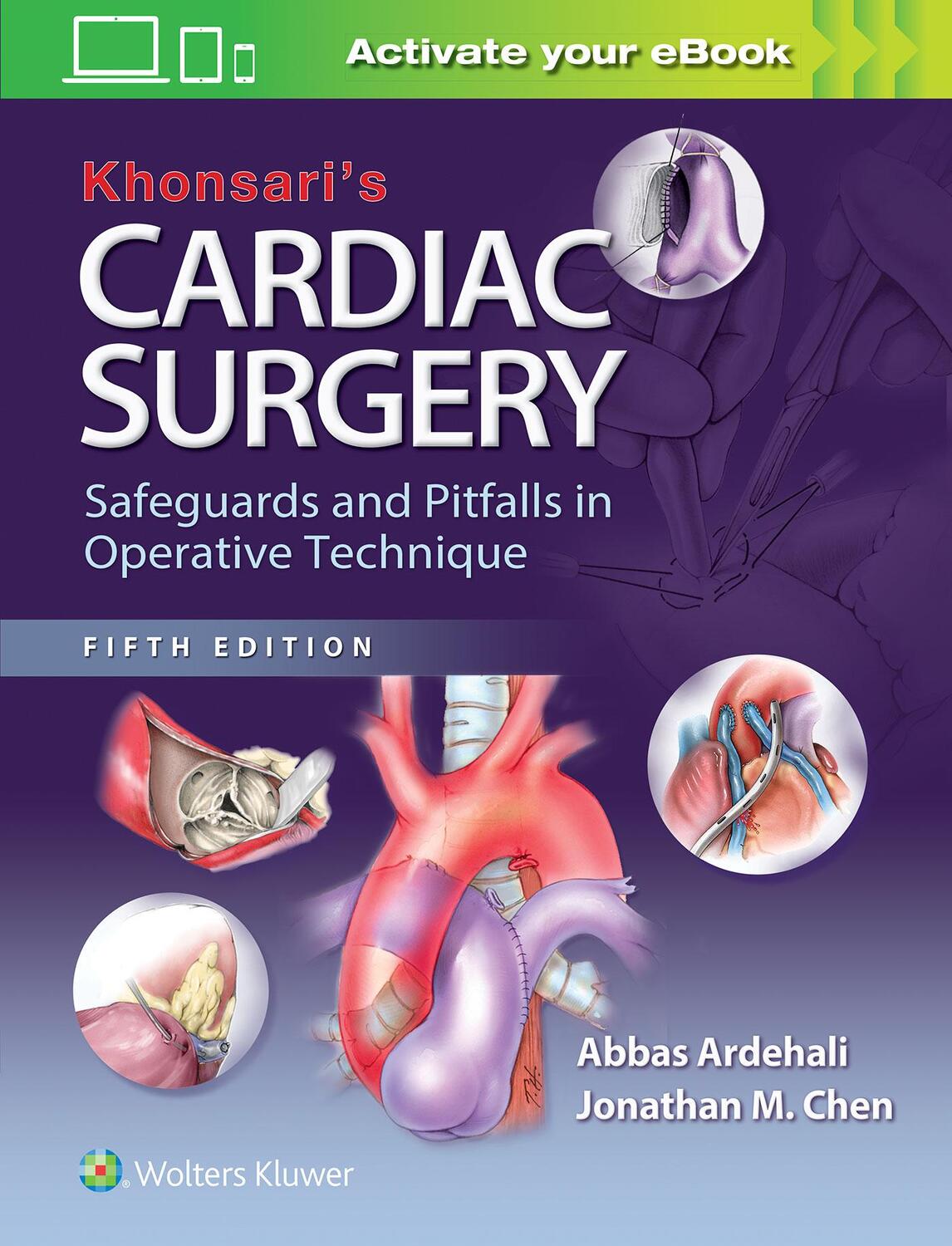 Cover: 9781451183689 | Khonsari's Cardiac Surgery | Abbas Ardehali | Buch | Englisch | 2016