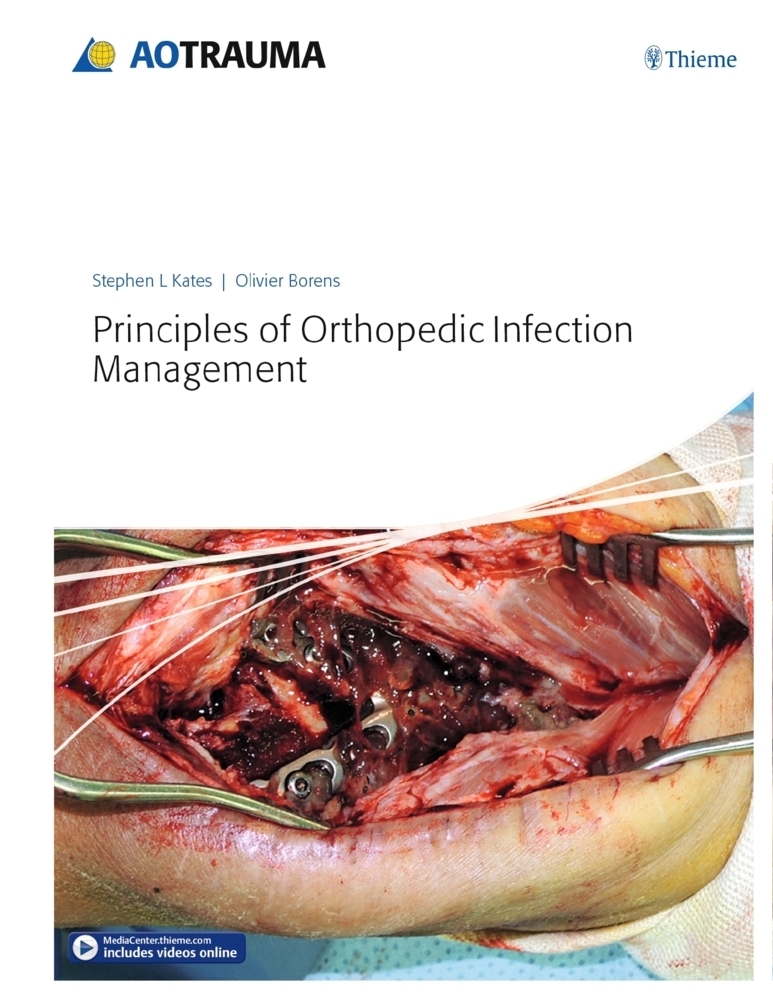 Cover: 9783132410756 | Principles of Orthopedic Infection Management | Stephen Kates (u. a.)