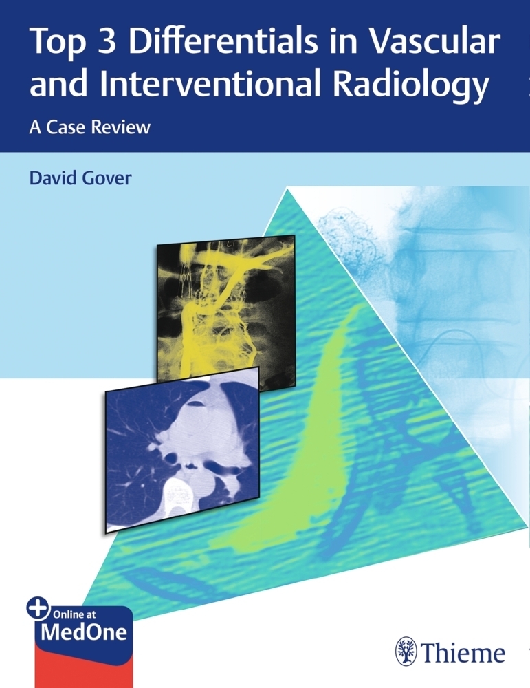 Cover: 9781626233560 | Top 3 Differentials in Vascular and Interventional Radiology | Gover