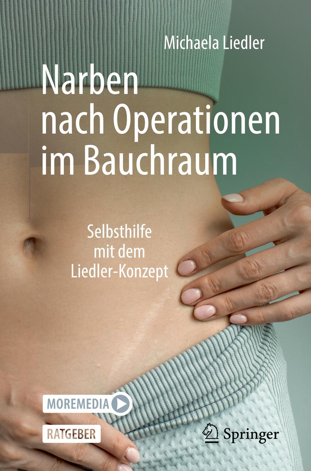 Cover: 9783662684818 | Narben nach Operationen im Bauchraum | Michaela Liedler | Taschenbuch