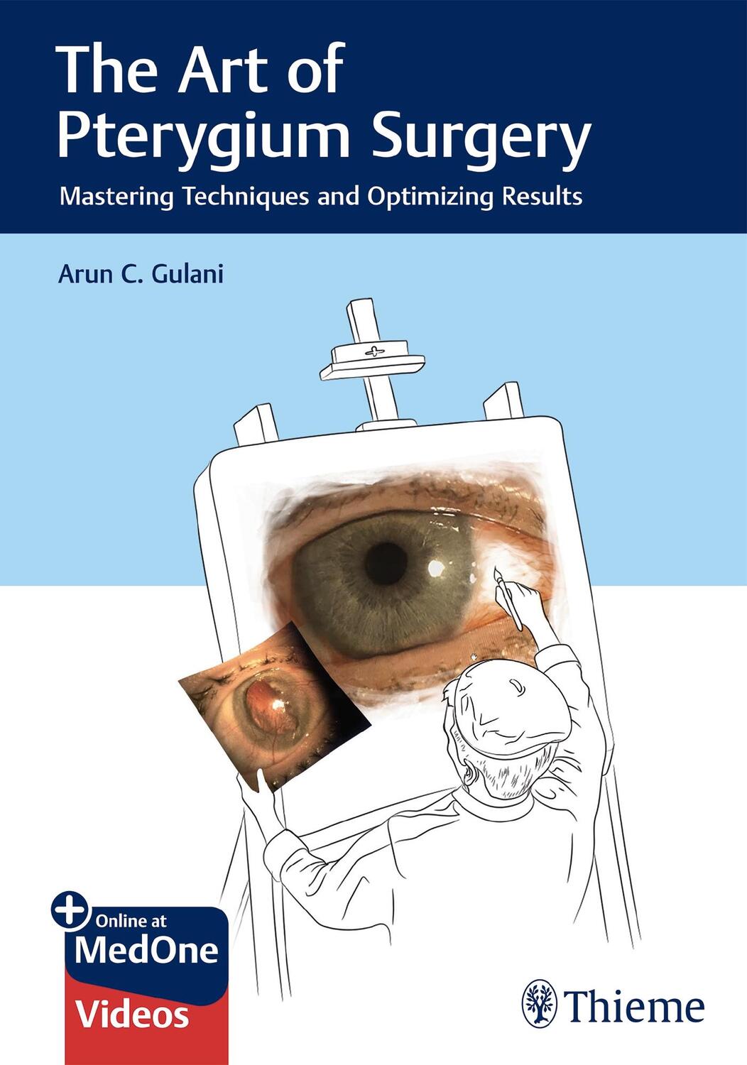 Cover: 9781626235113 | The Art of Pterygium Surgery | Arun C Gulani | Buch | 1 Buch | 2019