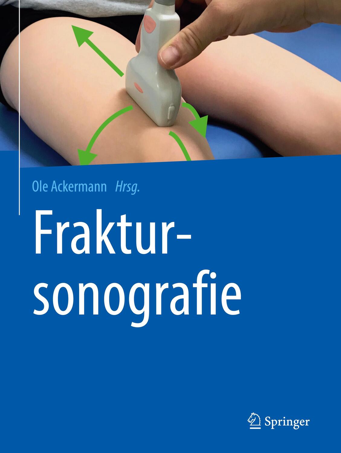 Cover: 9783662585078 | Fraktursonografie | Ole Ackermann | Buch | Springer