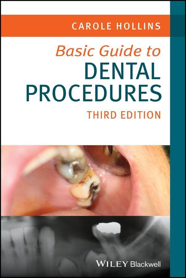 Cover: 9781394187874 | Basic Guide to Dental Procedures | Carole Hollins | Taschenbuch | 2024