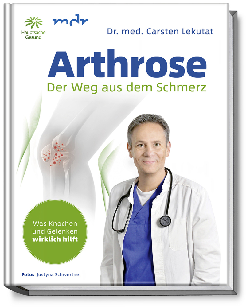 Cover: 9783954531554 | Arthrose | Carsten Lekutat | Buch | Deutsch | 2018 | Becker-Joest-Volk