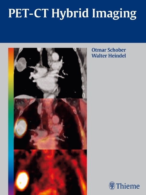 Cover: 9783131488619 | PET-CT Hybrid Imaging | Otmar Schober (u. a.) | Buch | 312 S. | 2010