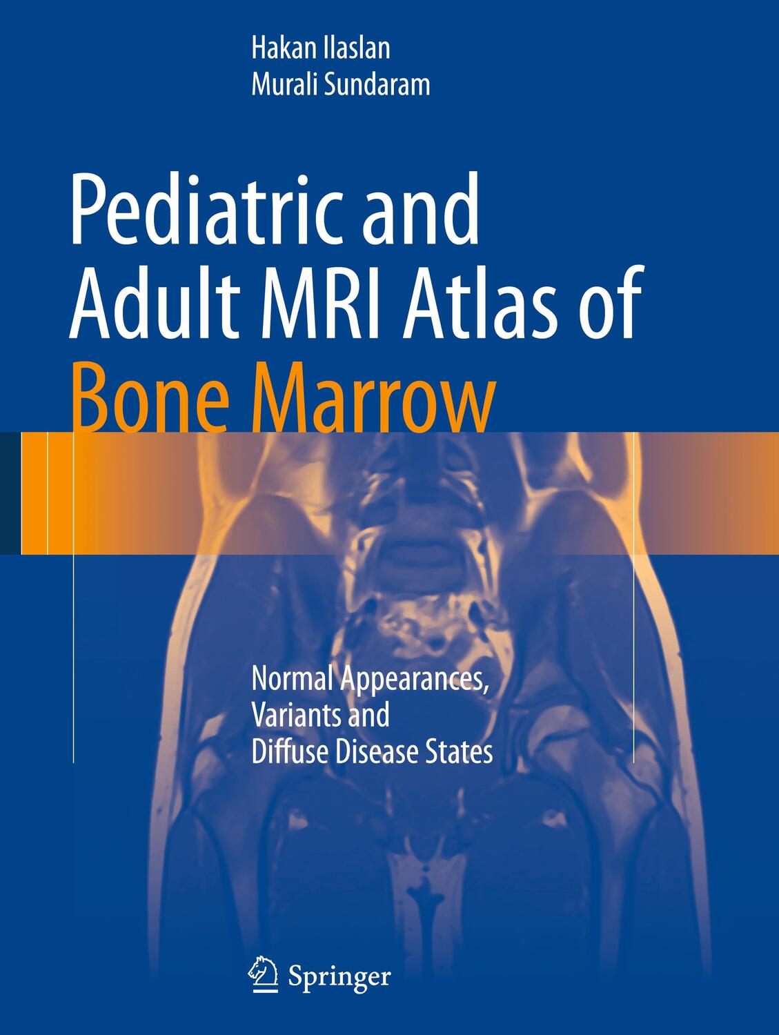 Cover: 9783642027390 | Pediatric and Adult MRI Atlas of Bone Marrow | Murali Sundaram (u. a.)