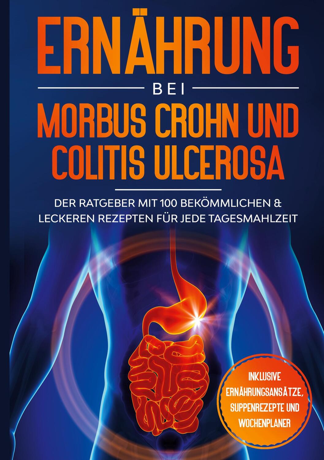 Cover: 9783755758600 | Ernährung bei Morbus Crohn und Colitis Ulcerosa: Der Ratgeber mit...