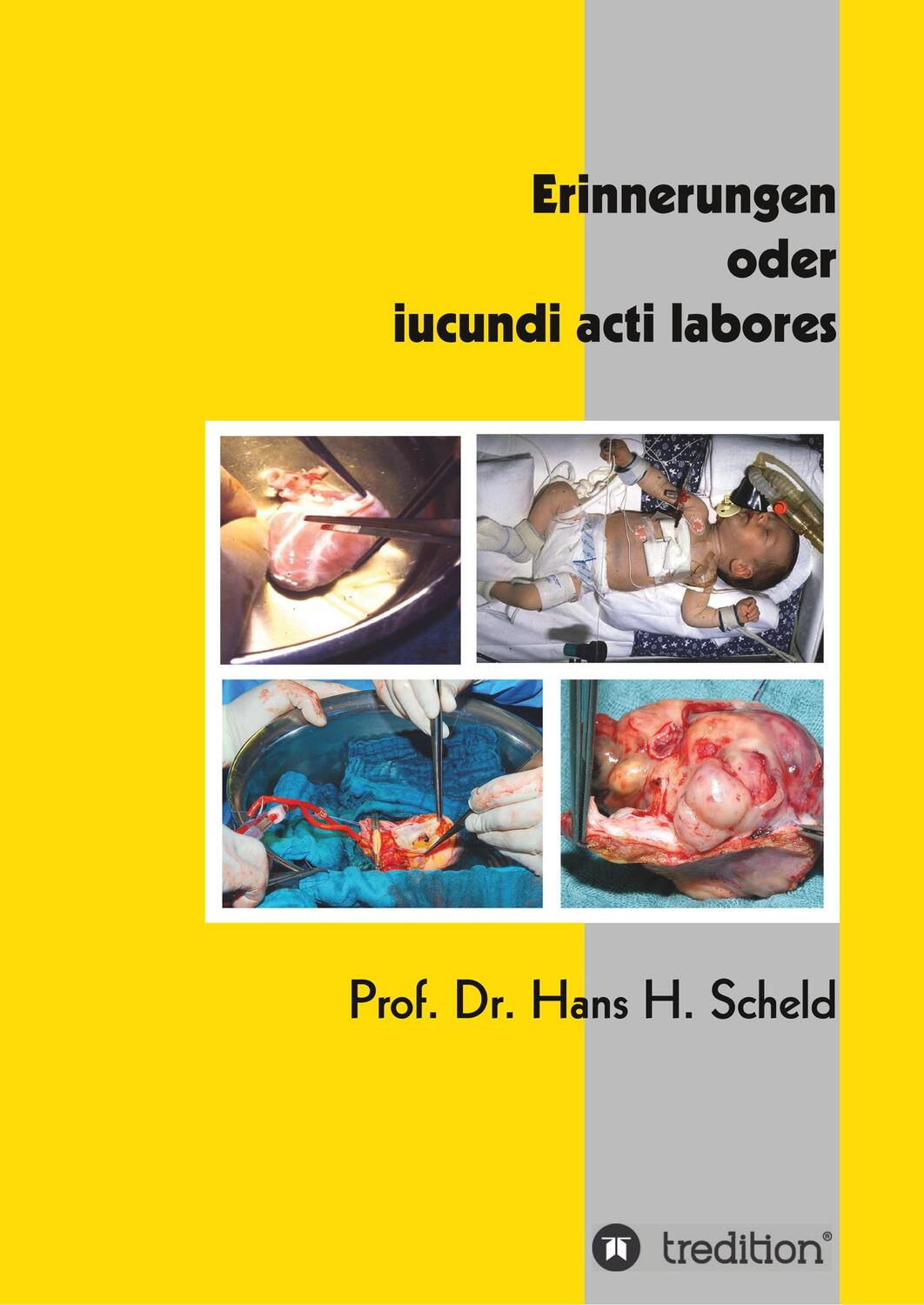 Cover: 9783749774791 | Erinnerungen oder iucundi acti labores | Hans H. Scheld | Taschenbuch