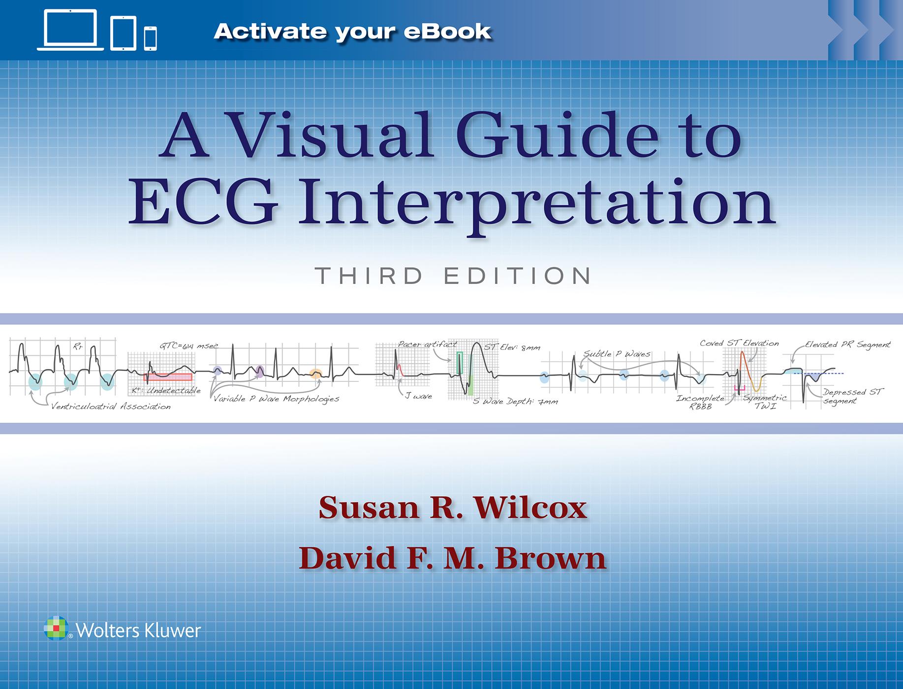 Cover: 9781975213589 | A Visual Guide to ECG Interpretation: Print + eBook with Multimedia