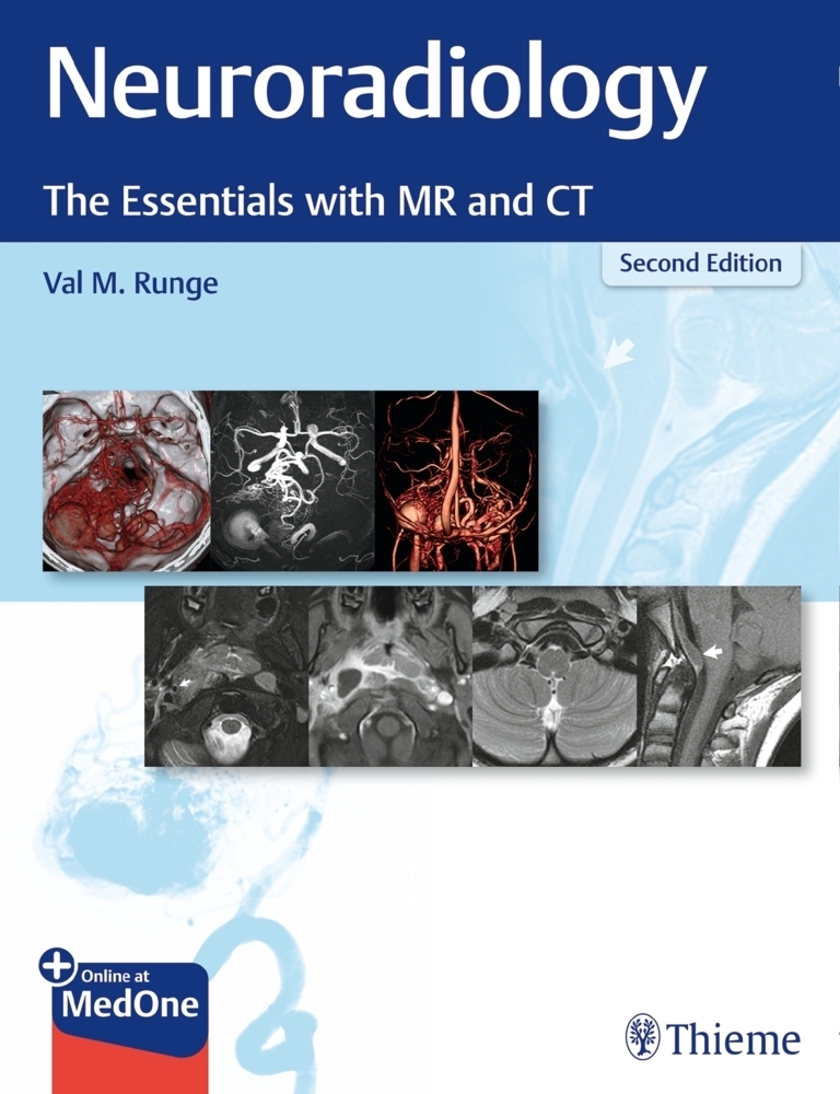Cover: 9781684201532 | Neuroradiology | The Essentials with MR and CT. With online access