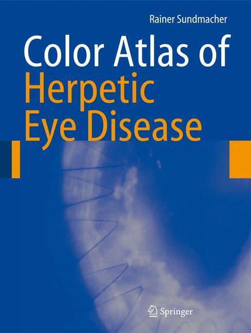 Cover: 9783642088995 | Color Atlas of Herpetic Eye Disease | Rainer Sundmacher | Taschenbuch