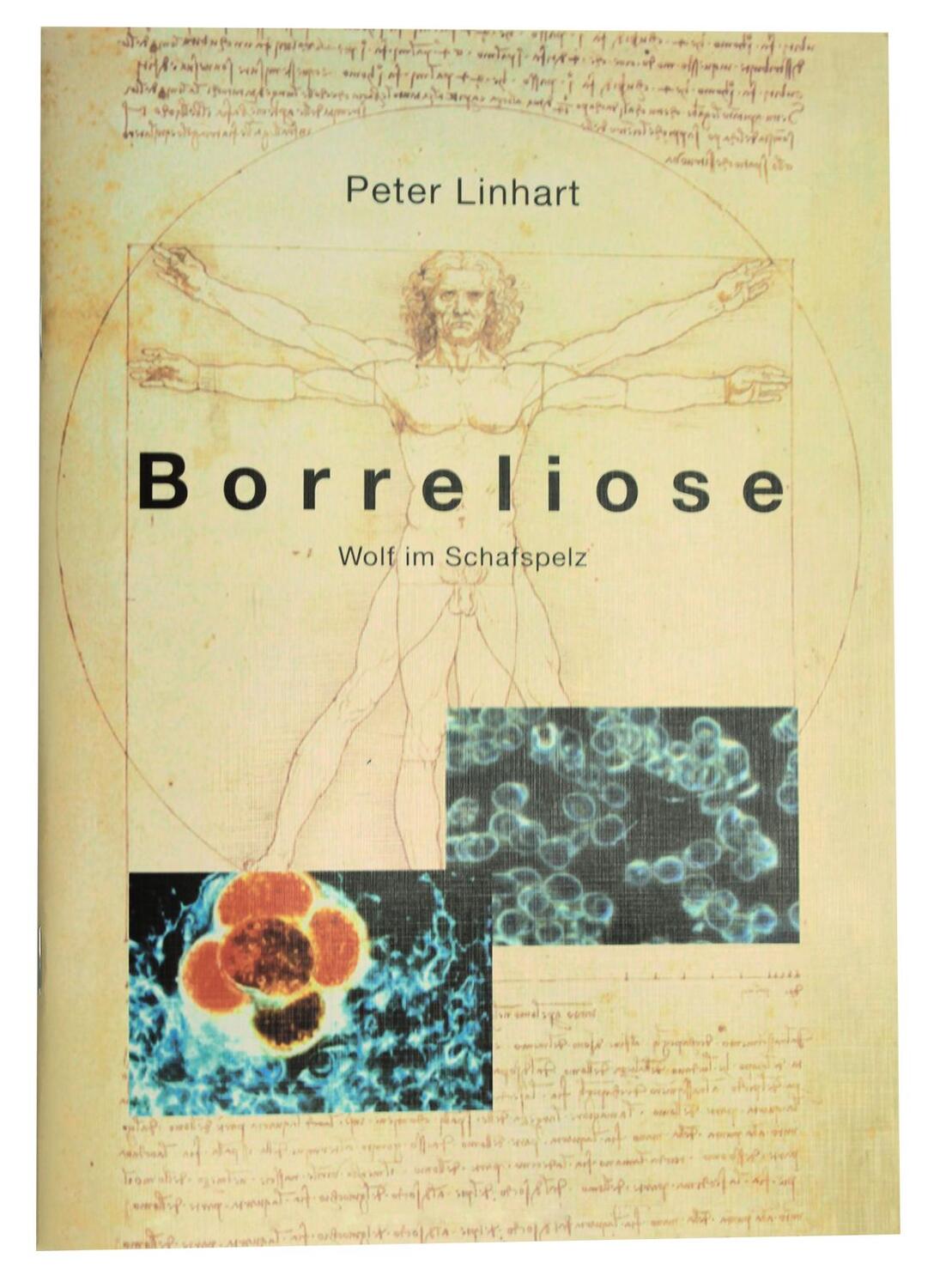 Cover: 9783925524868 | Borreliose - Wolf im Schafspelz | Peter Linhart | Broschüre | Deutsch