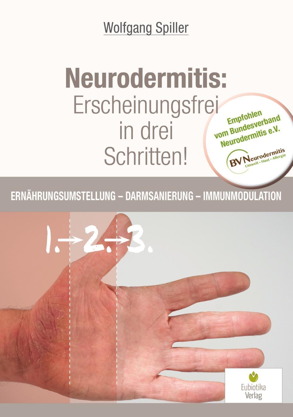 Cover: 9783944592183 | Neurodermitis: Erscheinungsfrei in drei Schritten! | Spiller Wolfgang