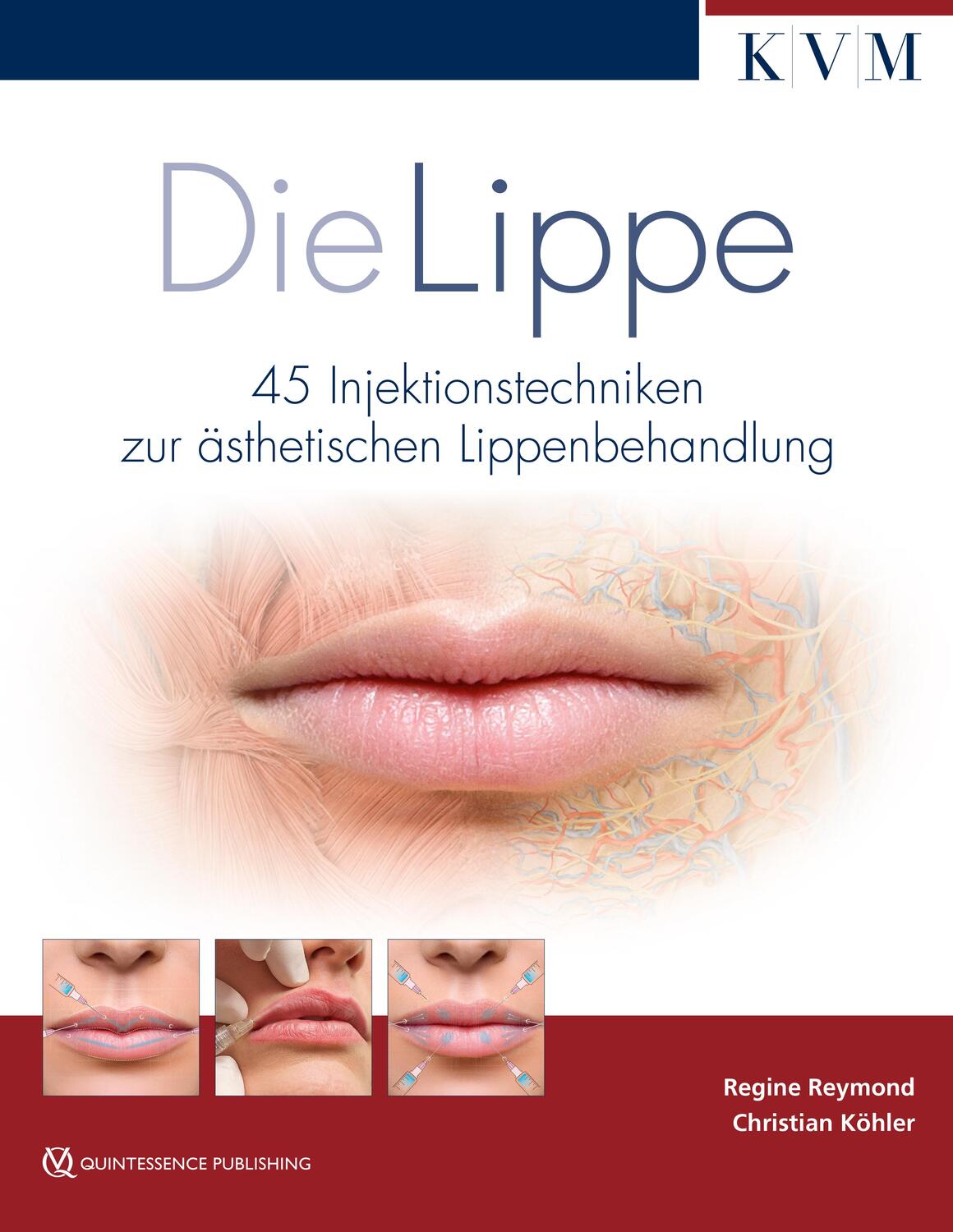 Cover: 9783868674026 | Die Lippe | 45 Injektionstechniken zur ästhetischen Lippenbehandlung