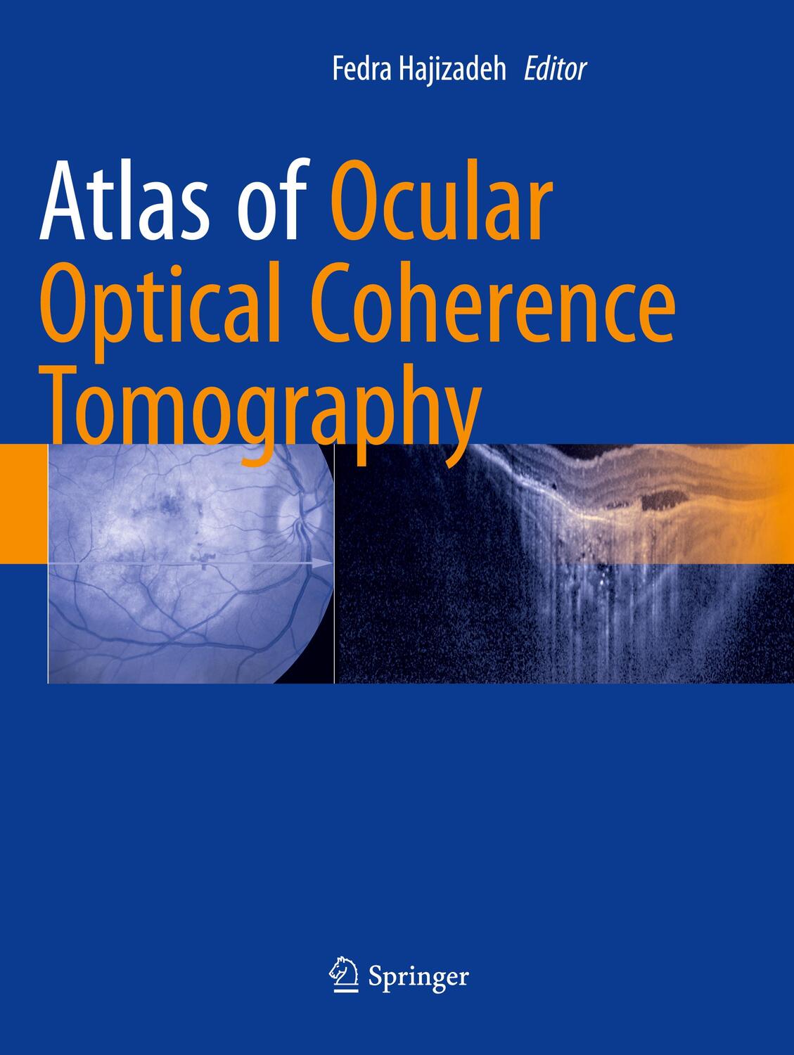 Cover: 9783319883144 | Atlas of Ocular Optical Coherence Tomography | Fedra Hajizadeh | Buch