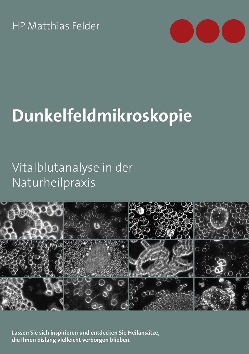Cover: 9783746099538 | Dunkelfeldmikroskopie | Vitalblutanalyse in der Naturheilpraxis | Buch