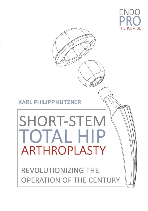 Cover: 9783759842206 | Short-Stem Total Hip Arthroplasty | Karl Philipp Kutzner | Taschenbuch