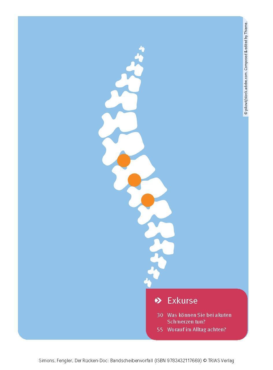Bild: 9783432117669 | Der Rücken-Doc: Bandscheibenvorfall | Patrick Simons (u. a.) | Buch