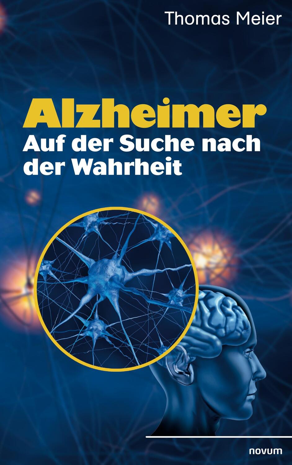 Cover: 9783991310051 | Alzheimer - Auf der Suche nach der Wahrheit | Thomas Meier | Buch
