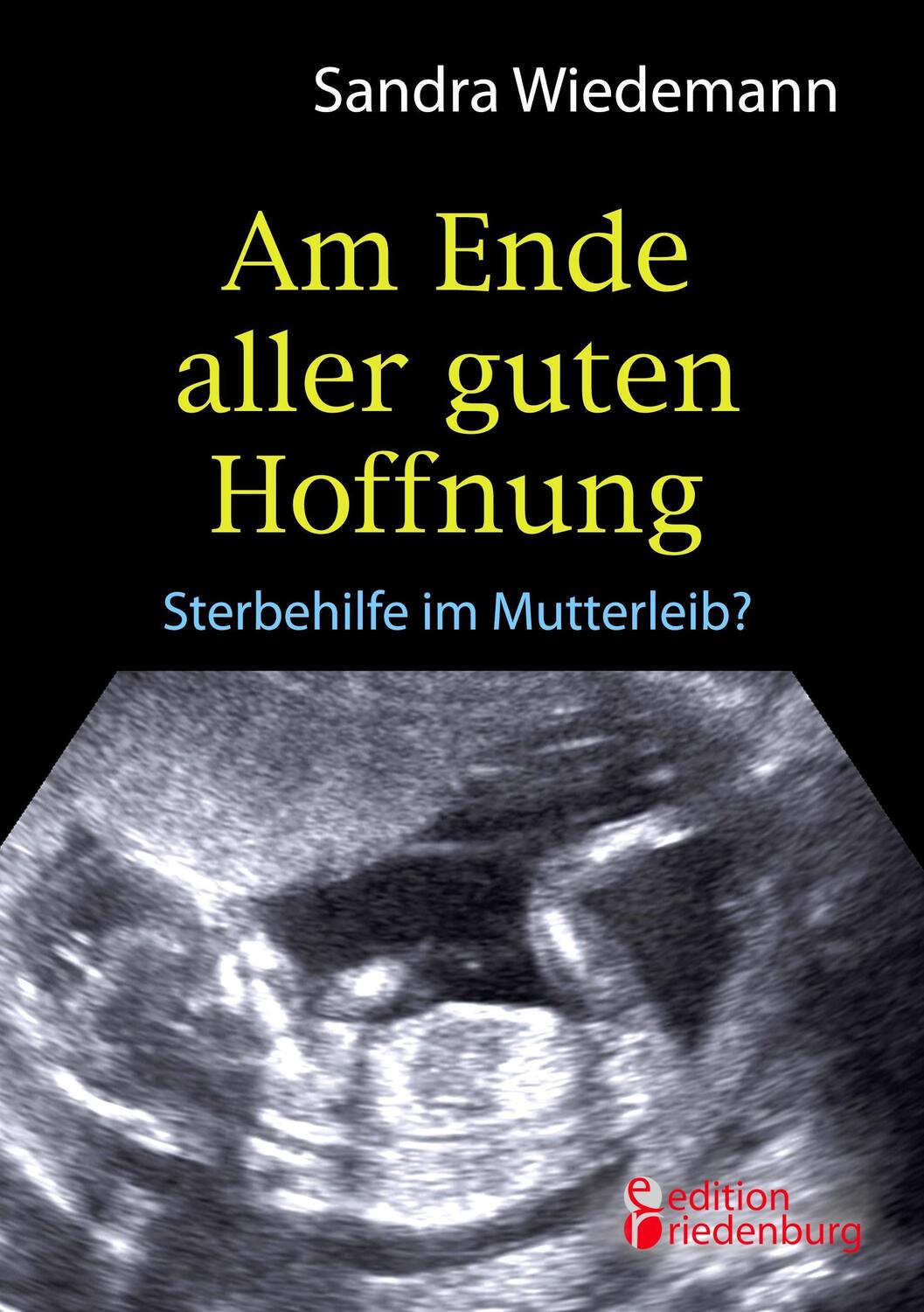 Cover: 9783902943613 | Am Ende aller guten Hoffnung - Sterbehilfe im Mutterleib?...