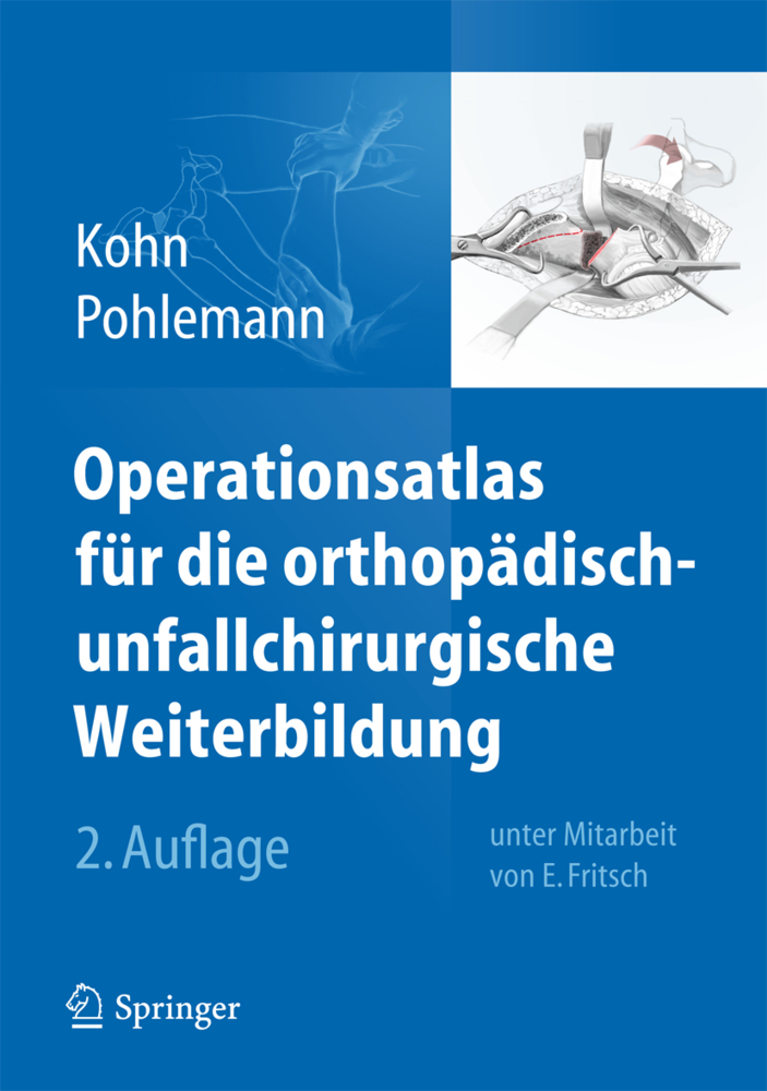 Cover: 9783642384202 | Operationsatlas für die orthopädisch-unfallchirurgische Weiterbildung
